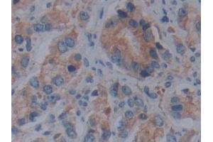 Immunohistochemistry (IHC) image for anti-Fibrillin 1 (FBN1) (AA 246-389) antibody (ABIN7438742)