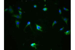 Immunofluorescence staining of SH-SY5Y cells with ABIN7127710 at 1:100,counter-stained with DAPI. (Recombinant MAPT antibody  (pSer324))