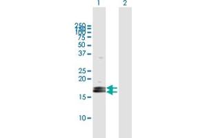 Western Blot analysis of LOC124220 expression in transfected 293T cell line by LOC124220 MaxPab polyclonal antibody. (ZG16B antibody  (AA 1-172))