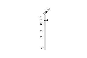 Western blot analysis of lysate from LNCap cell line, using CYP51A1 Antibody (Center) (ABIN652820 and ABIN2842535).