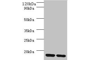 Western blot All lanes: MRPL55 antibody at 2 μg/mL Lane 1: K562 whole cell lysaye Lane 2: PC-3 whole cell lysaye Secondary Goat polyclonal to rabbit IgG at 1/10000 dilution Predicted band size: 16, 19 kDa Observed band size: 16 kDa (MRPL55 antibody  (AA 34-128))