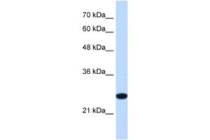 Western Blotting (WB) image for anti-Transmembrane Protein 109 (TMEM109) antibody (ABIN2463292) (TMEM109 antibody)