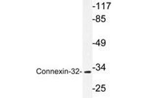 Western blot analysis of Connexin-32 antibody in extracts from LOVO cells. (GJB1 antibody)