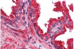 Human Prostate: Formalin-Fixed, Paraffin-Embedded (FFPE) (RRAS2 antibody  (AA 1-205))