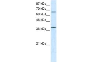 Western Blotting (WB) image for anti-Medium-Chain Specific Acyl-CoA Dehydrogenase, Mitochondrial antibody (ABIN2460575) (Medium-Chain Specific Acyl-CoA Dehydrogenase, Mitochondrial antibody)