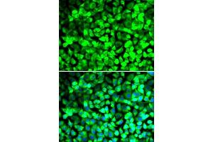 Immunofluorescence analysis of U2OS cells using EIF5 antibody. (EIF5 antibody  (AA 1-235))