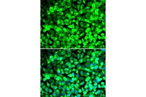 Immunofluorescence analysis of U2OS cells using EIF5 antibody. (EIF5 antibody  (AA 1-235))
