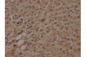 Immunohistochemistry (IHC) image for anti-Mitogen-Activated Protein Kinase Kinase Kinase Kinase 4 (MAP4K4) (AA 866-1104) antibody (ABIN7160070)