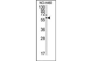 Image no. 1 for anti-Matrix Metallopeptidase 17 (Membrane-inserted) (MMP17) (Middle Region) antibody (ABIN358690) (MMP17 antibody  (Middle Region))