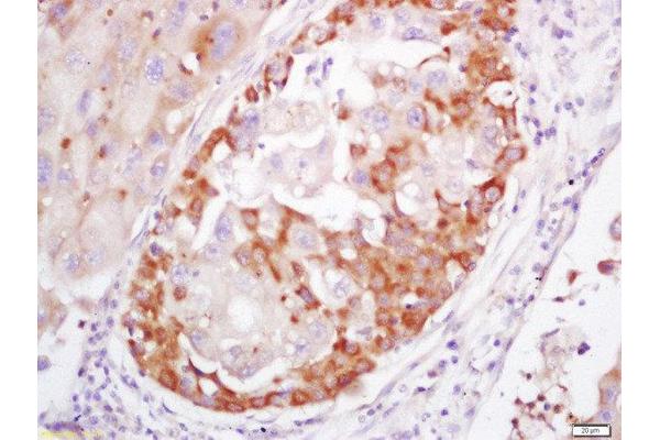 s100a4 antibody  (AA 15-101)