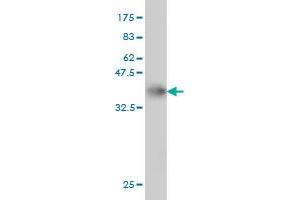 Western Blot detection against Immunogen (36. (TBCK antibody  (AA 601-700))