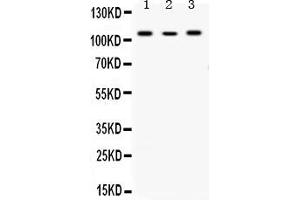 Western blot analysis of Alpha Actinin 4 expression in rat liver extract ( Lane 1), NEURO whole cell lysates ( Lane 2) and RAJI whole cell lysates ( Lane 3).