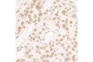 Immunohistochemistry (IHC) image for anti-Fused in Sarcoma (FUS) (AA 1-50) antibody (ABIN7448573)