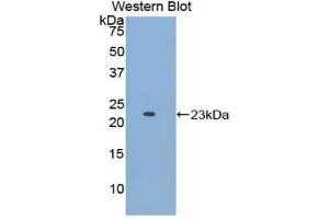 Detection of Recombinant APOE, Human using Polyclonal Antibody to Apolipoprotein E (APOE) (APOE antibody  (AA 19-181))