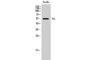Western Blotting (WB) image for anti-Ets Variant 6 (ETV6) (Ser37) antibody (ABIN3177671) (ETV6 antibody  (Ser37))