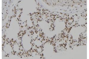 ABIN6276999 at 1/100 staining Rat lung tissue by IHC-P. (PSMC2 antibody  (Internal Region))