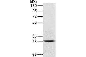 Western blot analysis of Mouse brain tissue, using TREM2 Polyclonal Antibody at dilution of 1:250 (TREM2 antibody)