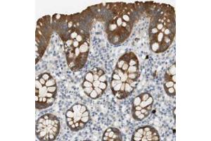 Immunohistochemical staining (Formalin-fixed paraffin-embedded sections) of human colon with PDE3A polyclonal antibody  shows strong cytoplasmic positivity in glandular cells. (PDE3A antibody)