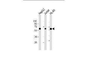 All lanes : Anti-CASP8 Antibody (C-term) at 1:2000 dilution Lane 1: HepG2 whole cell lysate Lane 2: Jurkat whole cell lysate Lane 3: HL-60 whole cell lysate Lysates/proteins at 20 μg per lane. (Caspase 8 antibody  (C-Term))