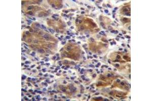 Immunohistochemistry analysis in human stomach tissue (Formalin-fixed, Paraffin-embedded) using Melanophilin / MLPH   Antibody (C-term), followed by peroxidase conjugation of the secondary antibody and DAB staining. (Melanophilin antibody  (C-Term))