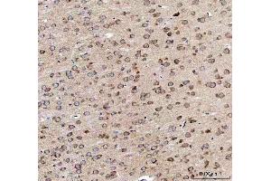 IHC analysis of EEA1 using anti-EEA1 antibody (ABIN5692856). (EEA1 antibody)