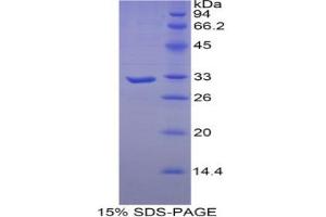 SDS-PAGE analysis of Human Myosin Heavy Chain 16 Protein. (MYH16 Protein)
