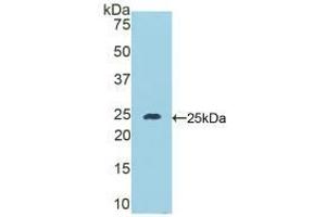 Western blot analysis of recombinant Mouse DSC1.