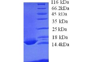 SDS-PAGE (SDS) image for Apolipoprotein C-IV (APOC4) (AA 27-127) protein (His tag) (ABIN4974590)