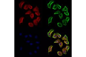 ABIN6265372 and ABIN6272932 staining Hela cells by IF/ICC. (SULT4A1 antibody  (C-Term))