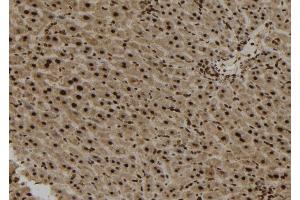 ABIN6273166 at 1/100 staining Mouse liver tissue by IHC-P. (SPG11 antibody  (Internal Region))