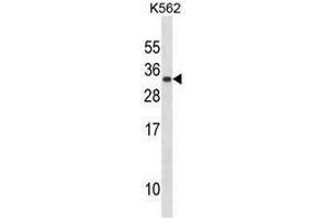 PRL Antibody (C-term) western blot analysis in K562 cell line lysates (35µg/lane). (Prolactin antibody  (C-Term))