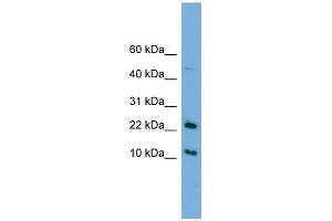 GM2A antibody used at 1 ug/ml to detect target protein. (GM2A antibody  (N-Term))