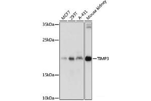 Western blot analysis of extracts of various cell lines using TIMP3 Polyclonal Antibody at dilution of 1:1000. (TIMP3 antibody)