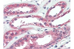 Human Kidney (formalin-fixed, paraffin-embedded) stained with ARHGEF17at 5 µg/ml followed by biotinylated goat anti-rabbit IgG secondary antibody, alkaline phosphatase-streptavidin and chromogen. (ARHGEF17 antibody)