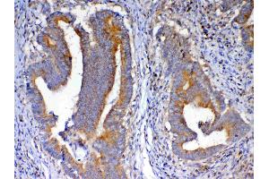 IHC analysis of NSF using anti-NSF antibody . (NSF antibody  (AA 620-744))