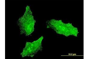 Immunofluorescence of monoclonal antibody to MKI67 on HeLa cell. (Ki-67 antibody  (AA 3157-3256))