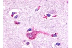 Immunohistochemical staining of Brain (Neurons and glia) using anti- GRM2 antibody ABIN122313 (GRM2 antibody  (N-Term))