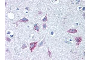 Image no. 1 for anti-Wingless-Type MMTV Integration Site Family, Member 8B (WNT8B) (Internal Region) antibody (ABIN400947) (WNT8B antibody  (Internal Region))