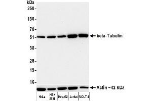 Western Blotting (WB) image for anti-Tubulin, beta (TUBB) (AA 1-50) antibody (ABIN7453995) (Recombinant TUBB antibody  (AA 1-50))