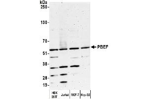 Western Blotting (WB) image for anti-Nicotinamide phosphoribosyltransferase (NAMPT) (AA 400-450) antibody (ABIN7454619) (NAMPT antibody  (AA 400-450))