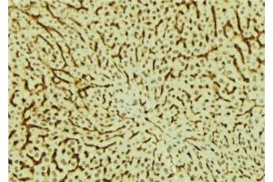 ABIN6279527 at 1/100 staining Mouse liver tissue by IHC-P. (MED28 antibody  (Internal Region))