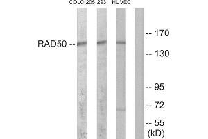 Western Blotting (WB) image for anti-RAD50 Homolog (S. Cerevisiae) (RAD50) (Internal Region) antibody (ABIN1850503) (RAD50 antibody  (Internal Region))