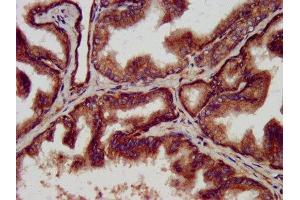 IHC image of ABIN7144958 diluted at 1:500 and staining in paraffin-embedded human prostate tissue performed on a Leica BondTM system. (CLPP antibody  (AA 223-277))