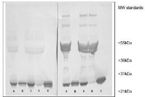 Western Blotting (WB) image for anti-C-Reactive Protein (CRP) antibody (ABIN781723) (CRP antibody)