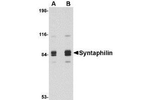 Image no. 1 for anti-Syntaphilin (SNPH) (Internal Region) antibody (ABIN1493822) (Syntaphilin antibody  (Internal Region))