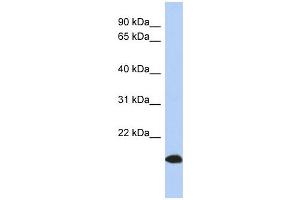 ARL17 antibody used at 1 ug/ml to detect target protein. (ARL17 antibody  (Middle Region))