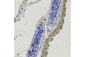 Immunohistochemistry of paraffin-embedded mouse lung using GAS6 antibody.
