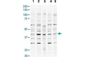 Western blot using USP18 polyclonal antibody  shows detection of a band ~43 KDa band (arrowhead) believed to be to USP18 in lysates from HeLa nuclear extracts (Lane 1) and whole cell lysates from HeLa (Lane 2), A-431 (Lane 3), Jurkat (Lane 4) and HEK293 (Lane 5). (USP18 antibody  (AA 40-49))
