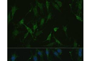 Immunofluorescence analysis of C6 cells using TRPV1 Polyclonal Antibody at dilution of 1:100. (TRPV1 antibody)