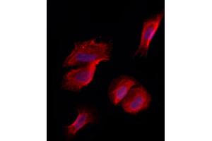 ABIN6263011 and ABIN6273265 staining Hela by IF/ICC.